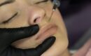 facial