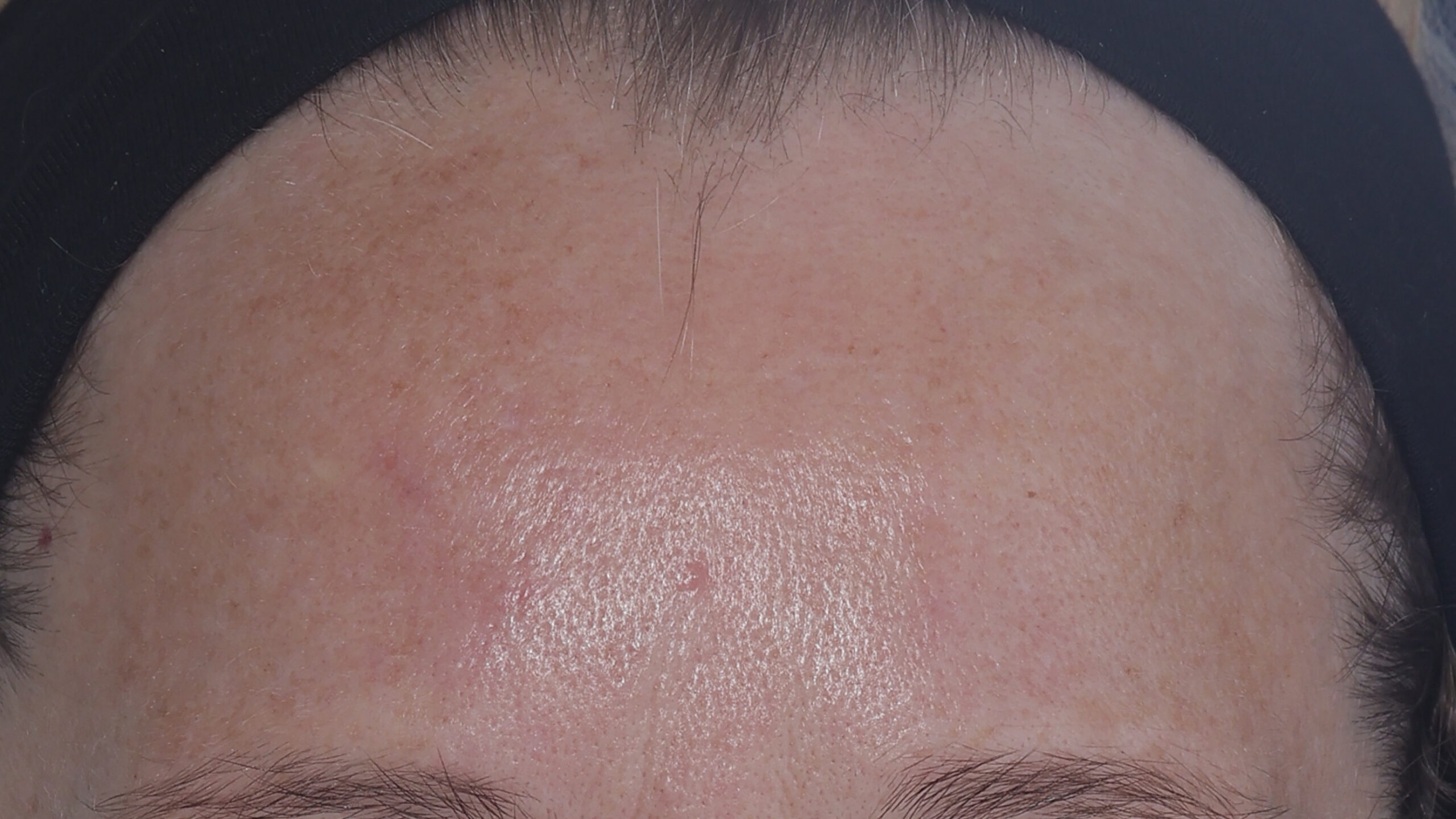 Anti-Wrinkle After
