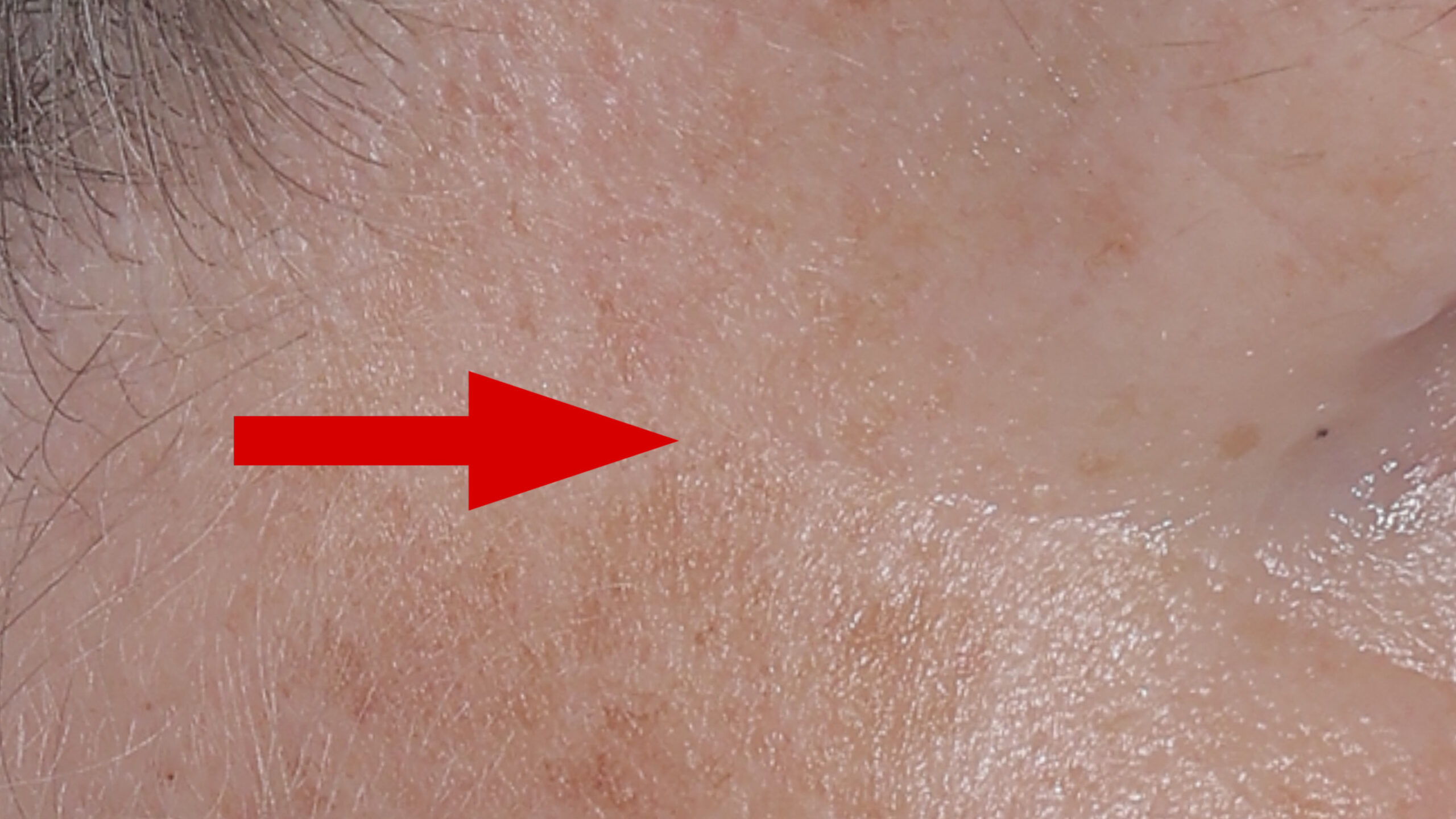 Anti-Wrinkle After