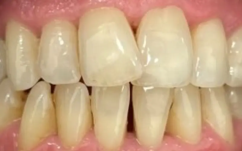 Whitening Before