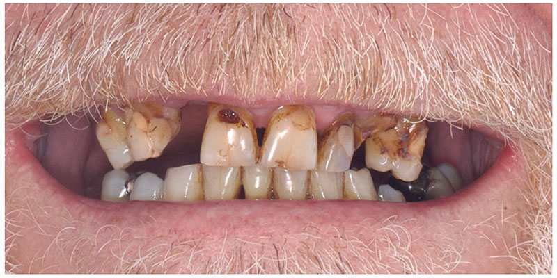 Smile Design Before